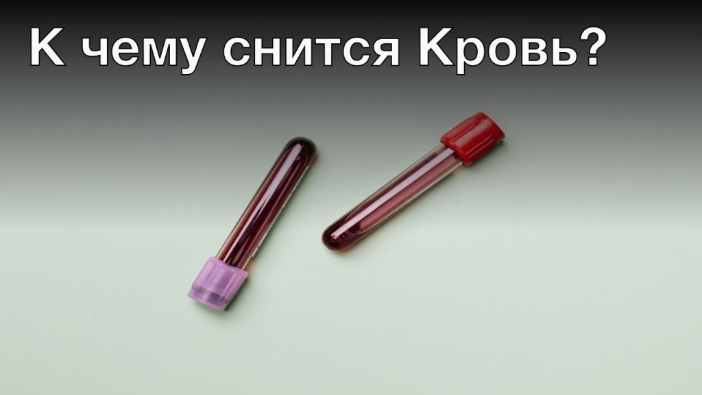К Чему Снится Кровь: Толкование, Символика и Значение Во Снах